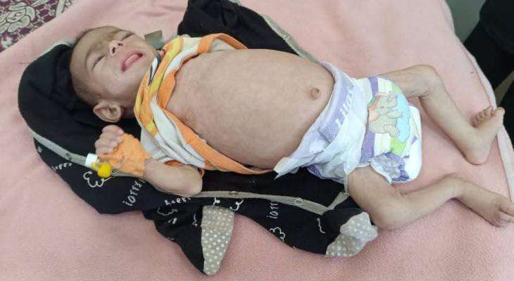 Gaza: Famine reaches catastrophic levels as sharp rise in death rates documented